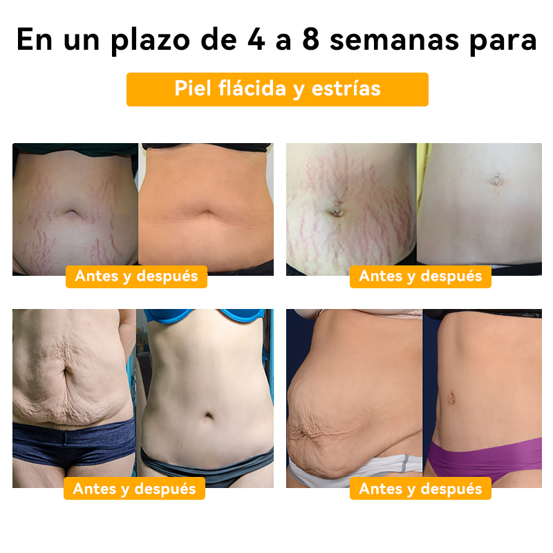 🌞𝐅𝐑𝐎𝐏𝐔𝐍™ 𝐕𝐞𝐧𝐞𝐧𝐨 𝐚𝐛𝐞𝐣𝐚 𝐀𝐝𝐞𝐥𝐠𝐚𝐳𝐚𝐧𝐭𝐞 𝐂𝐫𝐞𝐦𝐚🐝 (𝐩𝐚𝐫𝐚 𝐭𝐨𝐝𝐨𝐬 𝐨𝐬 𝐩𝐫𝐨𝐛𝐥𝐞𝐦𝐚𝐬 𝐥𝐢𝐧𝐟á𝐭𝐢𝐜𝐨𝐬 𝐞 𝐨𝐛𝐞𝐬𝐢𝐝𝐚𝐝𝐞)