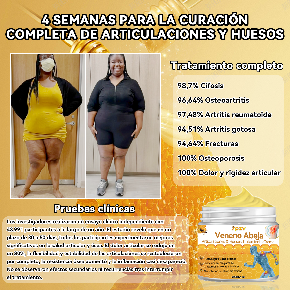 🦉𝐒𝐩𝐳𝐯™ 𝐕𝐞𝐧𝐞𝐧𝐨 𝐀𝐛𝐞𝐣𝐚 𝐀𝐫𝐭𝐢𝐜𝐮𝐥𝐚𝐜𝐢𝐨𝐧𝐞𝐬 & 𝐇𝐮𝐞𝐬𝐨𝐬 𝐓𝐫𝐚𝐭𝐚𝐦𝐢𝐞𝐧𝐭𝐨 𝐂𝐫𝐞𝐦𝐚 🐝(𝐄𝐱𝐭𝐫𝐚𝐜𝐭𝐨 𝐝𝐞 𝐚𝐛𝐞𝐣𝐚 𝐧𝐞𝐨𝐳𝐞𝐥𝐚𝐧𝐝𝐞𝐬𝐚 𝐞𝐬𝐩𝐞𝐜𝐢𝐚𝐥𝐢𝐳𝐚𝐝𝐨 𝐞𝐧 𝐞𝐧𝐟𝐞𝐫𝐦𝐞𝐝𝐚𝐝𝐞𝐬 𝐨𝐫𝐭𝐨𝐩é𝐝𝐢𝐜𝐚𝐬 𝐲 𝐝𝐨𝐥𝐨𝐫𝐞𝐬 𝐚𝐫𝐭𝐫í𝐭𝐢𝐜𝐨𝐬