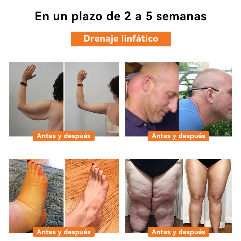 🏆𝐅𝐑𝐎𝐏𝐔𝐍™ 𝐕𝐞𝐧𝐞𝐧𝐨 𝐝𝐞 𝐚𝐛𝐞𝐣𝐚 𝐃𝐫𝐞𝐧𝐚𝐣𝐞 𝐥𝐢𝐧𝐟á𝐭𝐢𝐜𝐨𝐏𝐚𝐫𝐜𝐡𝐞 𝐚𝐝𝐞𝐥𝐠𝐚𝐳𝐚𝐧𝐭𝐞 (𝐏𝐚𝐫𝐚 𝐭𝐨𝐝𝐨𝐬 𝐥𝐨𝐬 𝐩𝐫𝐨𝐛𝐥𝐞𝐦𝐚𝐬 𝐥𝐢𝐧𝐟á𝐭𝐢𝐜𝐨𝐬 𝐲 𝐥𝐚 𝐨𝐛𝐞𝐬𝐢𝐝𝐚𝐝)