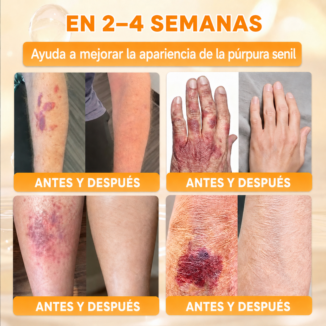 🔥🔥𝐓𝐢𝐞𝐧𝐝𝐚 𝐨𝐟𝐢𝐜𝐢𝐚𝐥 • 𝐅𝐚𝐛𝐫𝐢𝐜𝐚𝐝𝐨 𝐞𝐧 𝐄𝐬𝐩𝐚ñ𝐚 🧄𝗗𝗼𝗿𝗺𝗼𝗿𝗻𝗮® 𝗩𝗲𝗻𝗲𝗻𝗼 𝗱𝗲 𝗮𝗯𝗲𝗷𝗮 𝗖𝗿𝗲𝗺𝗮 𝗶𝗻𝘁𝗲𝗴𝗿𝗮𝗹 🌟Ú𝐋𝐓𝐈𝐌𝐎 𝐃Í𝐀 – 𝟖𝟎 % 𝐃𝐄 𝐃𝐄𝐒𝐂𝐔𝐄𝐍𝐓𝐎