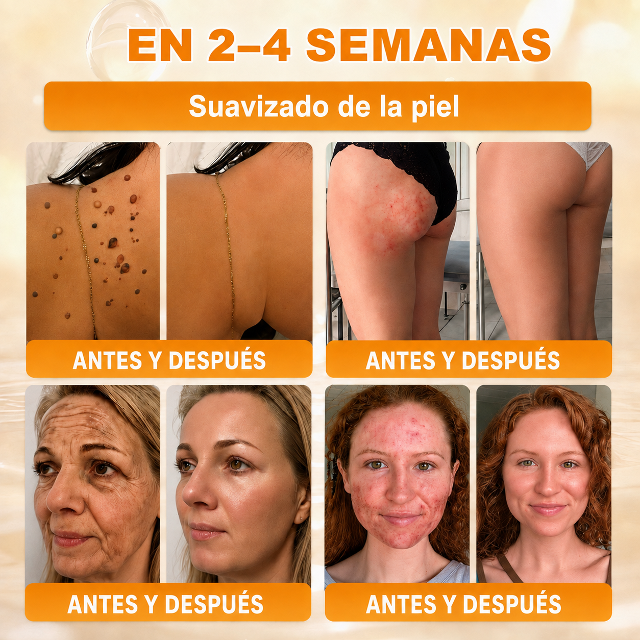 🔥🔥𝐓𝐢𝐞𝐧𝐝𝐚 𝐨𝐟𝐢𝐜𝐢𝐚𝐥 • 𝐅𝐚𝐛𝐫𝐢𝐜𝐚𝐝𝐨 𝐞𝐧 𝐄𝐬𝐩𝐚ñ𝐚 🧄𝗗𝗼𝗿𝗺𝗼𝗿𝗻𝗮® 𝗩𝗲𝗻𝗲𝗻𝗼 𝗱𝗲 𝗮𝗯𝗲𝗷𝗮 𝗖𝗿𝗲𝗺𝗮 𝗶𝗻𝘁𝗲𝗴𝗿𝗮𝗹 🌟Ú𝐋𝐓𝐈𝐌𝐎 𝐃Í𝐀 – 𝟖𝟎 % 𝐃𝐄 𝐃𝐄𝐒𝐂𝐔𝐄𝐍𝐓𝐎
