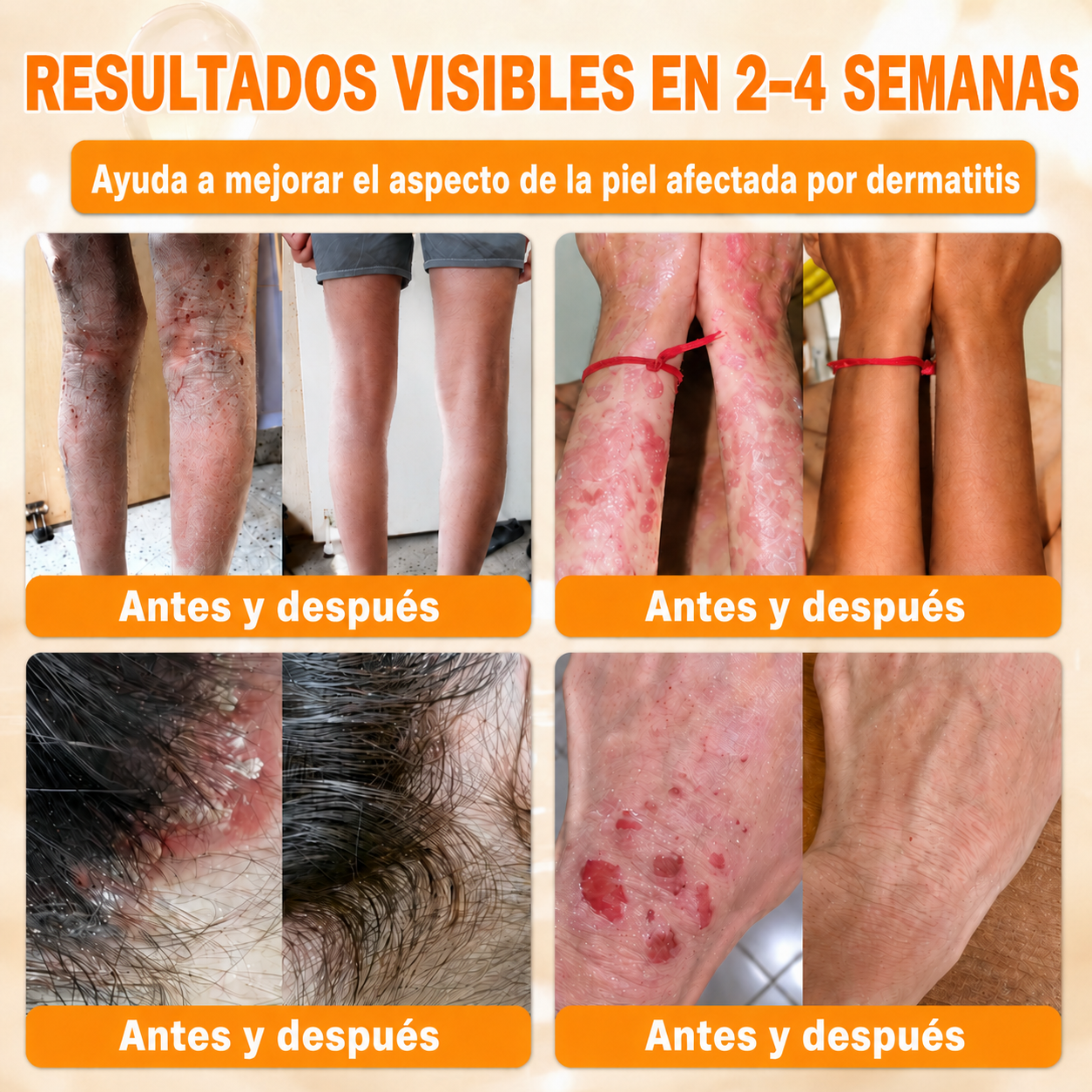 🔥🔥𝐓𝐢𝐞𝐧𝐝𝐚 𝐨𝐟𝐢𝐜𝐢𝐚𝐥 • 𝐅𝐚𝐛𝐫𝐢𝐜𝐚𝐝𝐨 𝐞𝐧 𝐄𝐬𝐩𝐚ñ𝐚 🧄𝗗𝗼𝗿𝗺𝗼𝗿𝗻𝗮® 𝗩𝗲𝗻𝗲𝗻𝗼 𝗱𝗲 𝗮𝗯𝗲𝗷𝗮 𝗖𝗿𝗲𝗺𝗮 𝗶𝗻𝘁𝗲𝗴𝗿𝗮𝗹 🌟Ú𝐋𝐓𝐈𝐌𝐎 𝐃Í𝐀 – 𝟖𝟎 % 𝐃𝐄 𝐃𝐄𝐒𝐂𝐔𝐄𝐍𝐓𝐎